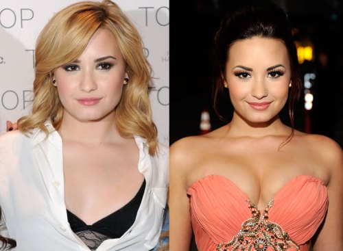 Demi Lovato Plastic Surgery