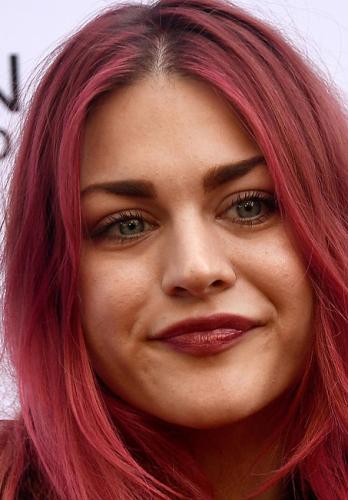 Frances Cobain Plastic Surgery