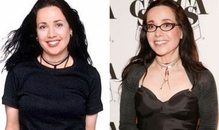 Janeane Garofalo Plastic Surgery