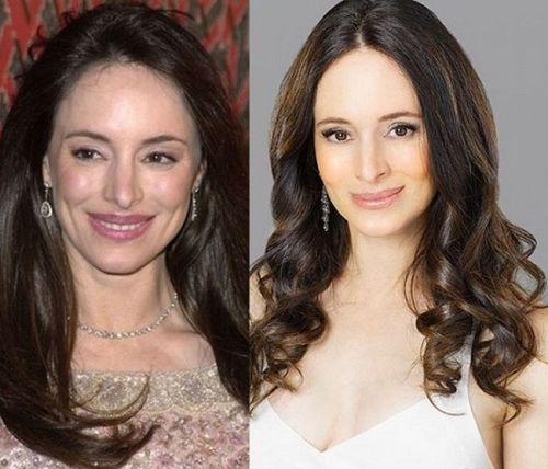 Madeleine Stowe Plastic Surgery