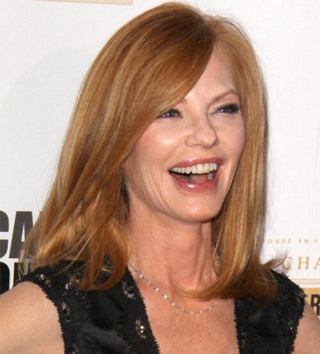 Marg Helgenberger Plastic Surgery