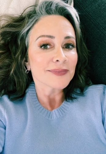 Patricia Heaton Plastic Surgery