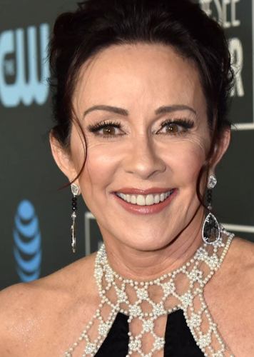 Patricia Heaton Plastic Surgery