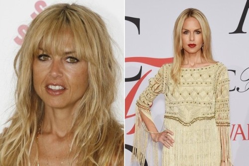 Rachel Zoe Plastic Surgery