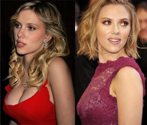 Scarlett Johansson Breast Reduction