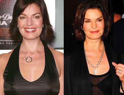 Sela Ward Plastic Surgery