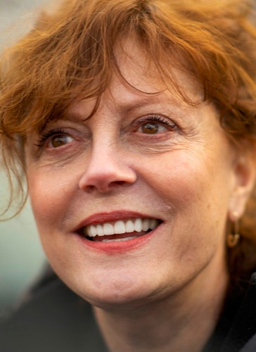 Susan Sarandon Plastic Surgery