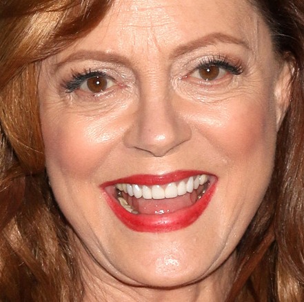 Susan Sarandon Plastic Surgery