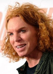 Carrot Top Plastic Surgery