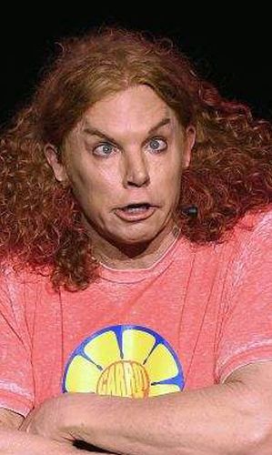 Carrot Top Plastic Surgery