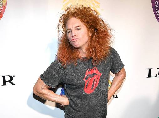 Carrot Top Plastic Surgery Lists