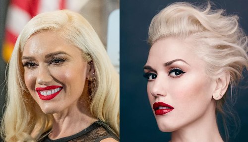 Gwen Stefani Plastic Surgery