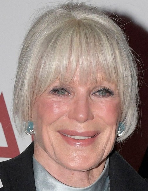 Linda Evans Plastic Surgery Gone Wrong