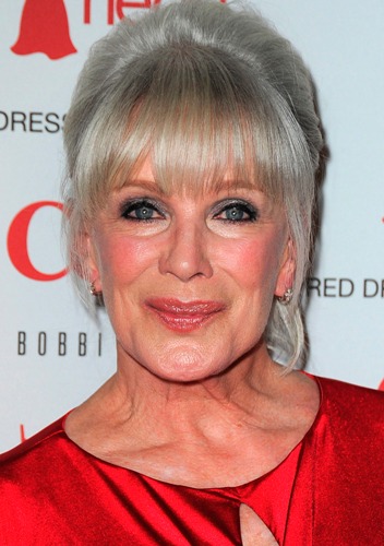 Linda Evans Plastic Surgery