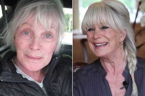 Linda Evans Plastic Surgery