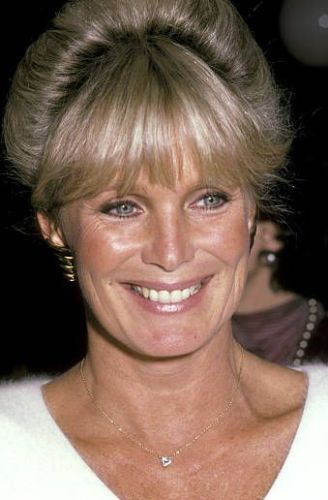 Linda Evans Plastic Surgery