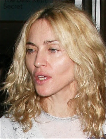 Madonna Plastic Surgery