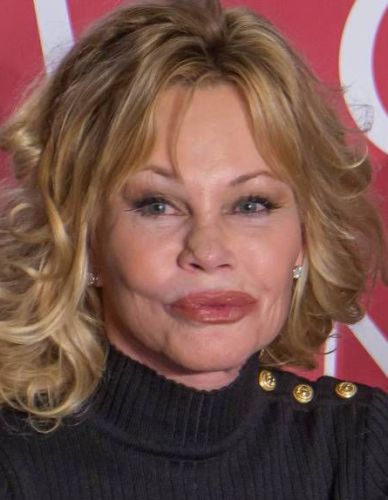 Melanie Griffith Plastic Surgery