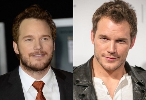 Chris Pratt Plastic Surgery