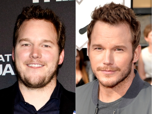 Chris Pratt Plastic Surgery