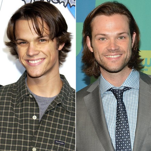 Jared Padalecki Plastic Surgery