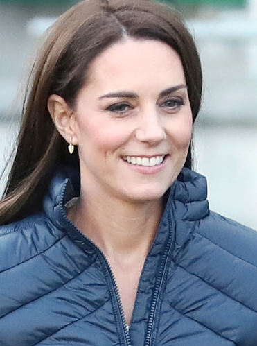 Kate Middleton Plastic Surgery