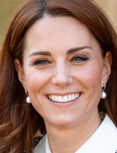 Kate Middleton Plastic Surgery