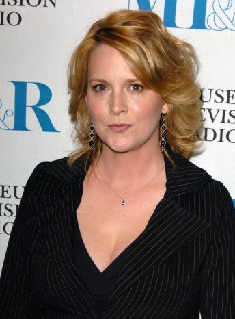 Laurel Holloman Plastic Surgery