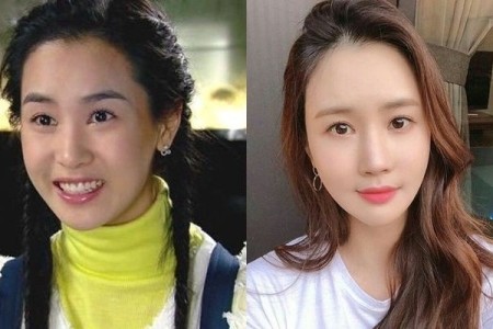 Lee Da Hae Plastic Surgery