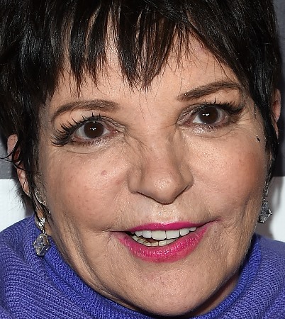 Liza Minnelli Plastic Surgery