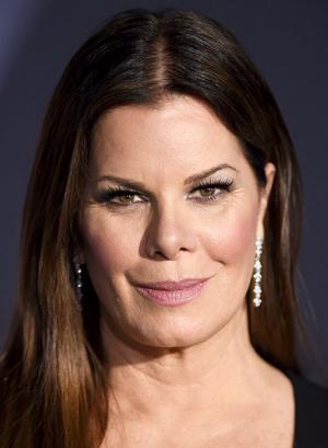 Marcia Gay Harden Plastic Surgery