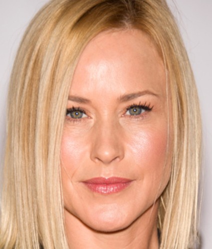 Patricia Arquette Plastic Surgery