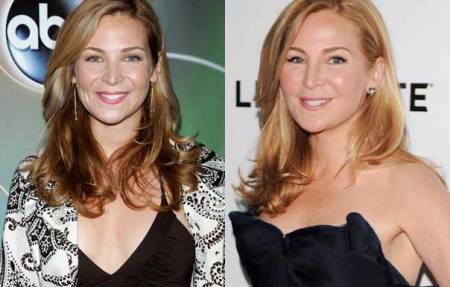 Jennifer Westfeldt Plastic Surgery