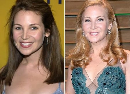 Jennifer Westfeldt Plastic Surgery