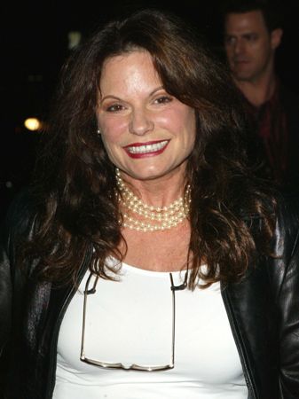 Kay Lenz Plastic Surgery