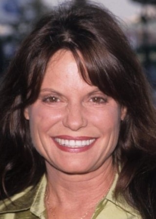 Kay Lenz Plastic Surgery