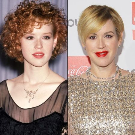 Molly Ringwald Plastic Surgery