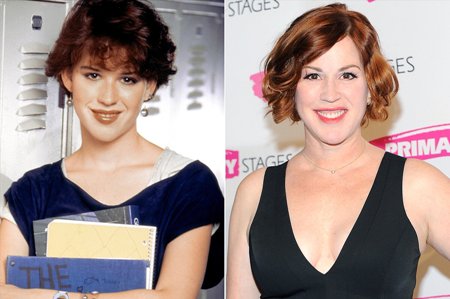 Molly Ringwald Plastic Surgery