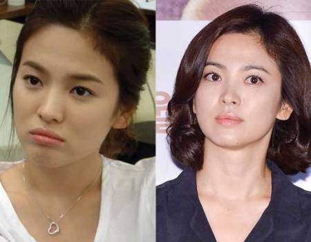 Song Hye Kyo Plastic Surgery