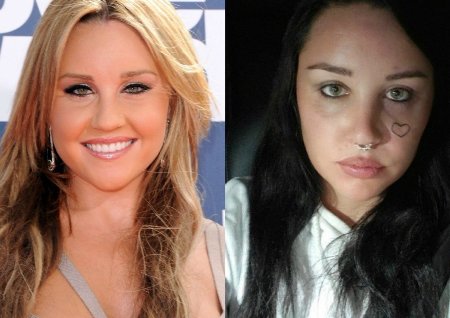 Amanda Bynes Plastic Surgery