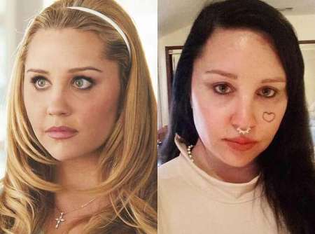 Amanda Bynes Plastic Surgery