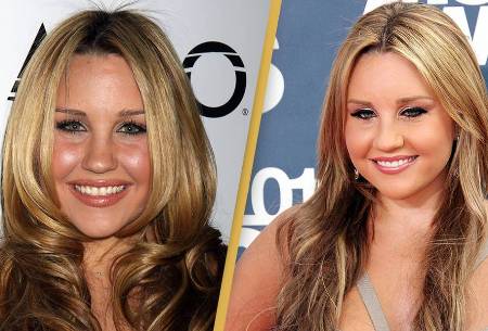 Amanda Bynes Plastic Surgery