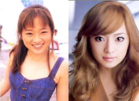 Ayumi Hamasaki Plastic Surgery