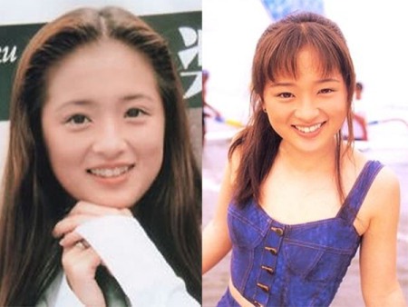 Ayumi Hamasaki Plastic Surgery