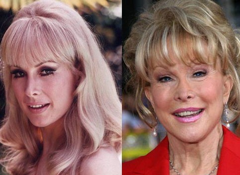 Barbara Eden Plastic Surgery