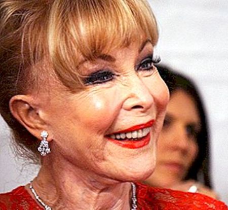 Barbara Eden Plastic Surgery