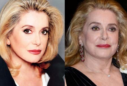 Catherine Deneuve Plastic Surgery