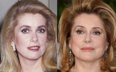 Catherine Deneuve Plastic Surgery