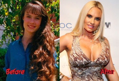 Coco Austin Plastic Surgery