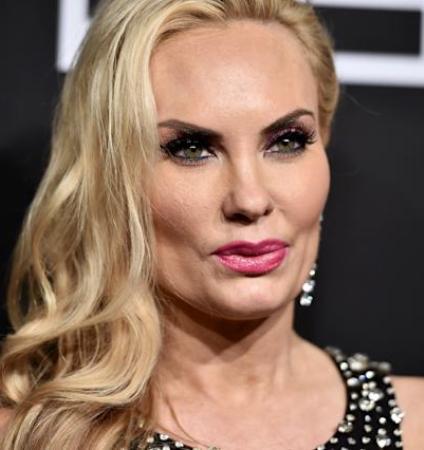 Coco Austin Plastic Surgery